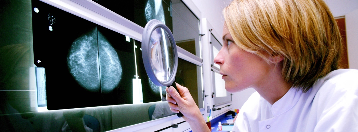 NCCN Clinical Practice Guidelines Recommend FES PET Imaging for ER+ Breast Cancer